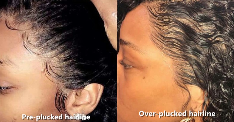 preplucked hairline