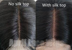 lace frontal vs silk base closure